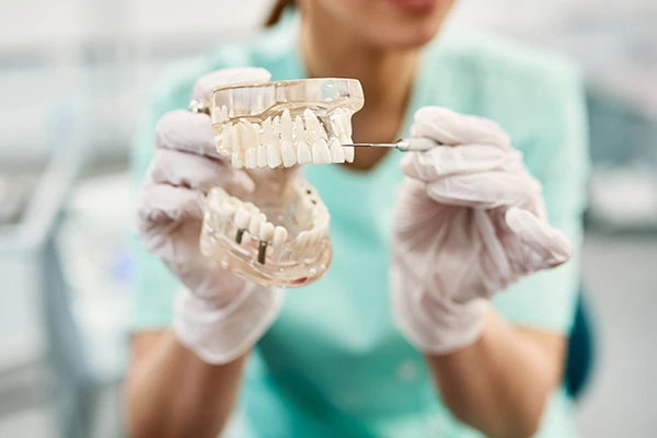 tratamiento implantes dentales en El Casar Guadalajara